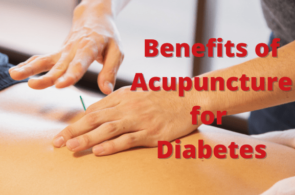 benefits of acupuncture for diabetes